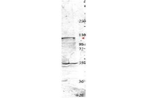 Western blot using  affinity purified anti-Nedd4 antibody shows detection of a 115 kDa band corresponding to endogenous Nedd4 (arrowhead) in MDA-MB-435S cell lysates. (NEDD4 抗体  (Internal Region))