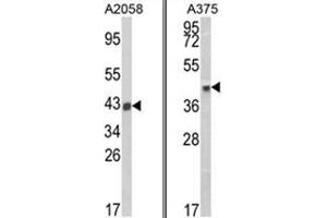 (LEFT) Western blot analysis of HLA-B Antibody (N-term) in A2058 cell line lysates (35ug/lane). (HLA B7 抗体  (N-Term))
