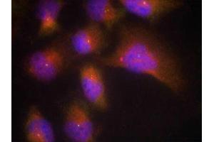 Immunofluorescence staining of methanol-fixed Hela cells using TrkB(Phospho-Tyr515) Antibody. (TRKB 抗体  (pTyr515))