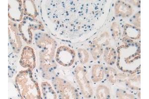 Detection of HMGB1 in Human Kidney Tissue using Polyclonal Antibody to High Mobility Group Protein 1 (HMGB1) (HMGB1 抗体  (AA 1-215))
