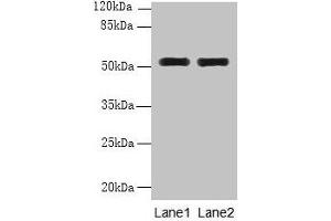 Western blot All lanes: WDR88 antibody at 6 μg/mL Lane 1: MCF-7 whole cell lysate Lane 2: A549 whole cell lysate Secondary Goat polyclonal to rabbit IgG at 1/10000 dilution Predicted band size: 53, 48 kDa Observed band size: 53 kDa (WDR88 抗体  (AA 1-250))