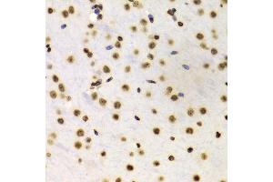 Immunohistochemistry (IHC) image for anti-Histone 3 (H3) (H3K4me) antibody (ABIN3023251)