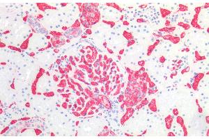 Immunohistochemistry staining of human kidney (paraffin-embedded sections) with anti-blood group A (HE-193), dilution 1:50. (ABO, Blood Group A Antigen 抗体)