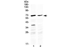 Western blot testing of human 1) HepG2 and 2) MCF7 cell lysate with MAK antibody at 0. (MAK 抗体  (AA 588-623))