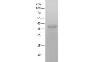 Western Blotting (WB) image for Synaptophysin (SYP) (AA 217-313) protein (His-IF2DI Tag) (ABIN7125269) (Synaptophysin Protein (SYP) (AA 217-313) (His-IF2DI Tag))