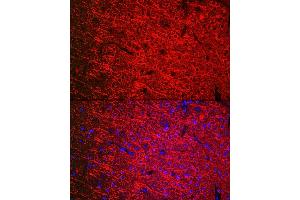 Immunofluorescence analysis of mouse brain cells using [KO Validated] βIII-Tubulin Mouse mAb  at dilution of 1:200 (40x lens). (TUBB3 抗体)
