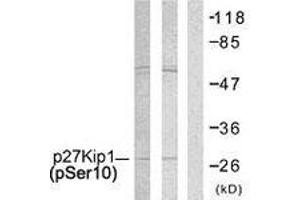 Western blot analysis of extracts from A2780 and COLO205 cells, using p27 Kip1 (Phospho-Ser10) Antibody. (CDKN1B 抗体  (pSer10))