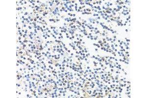 Immunohistochemistry of paraffin-embedded tonsil using HLA-DRB3 Polyclonal Antibody at dilution of 1:100 (40x lens). (HLA-DRB3 抗体)