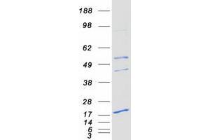 PEMT Protein (Transcript Variant 2) (Myc-DYKDDDDK Tag)