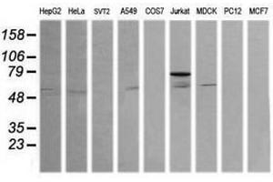 Image no. 4 for anti-ERG, ETS transcription factor (ERG) antibody (ABIN1498075) (ERG 抗体)