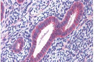 Human Uterus: Formalin-Fixed, Paraffin-Embedded (FFPE) (CCDC106 抗体  (C-Term))