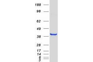 Western Blotting (WB) image for Poly(rC) Binding Protein 2 (PCBP2) (Transcript Variant 2) protein (Myc-DYKDDDDK Tag) (ABIN2728352)