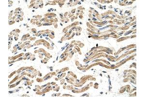 ALDH4A1 antibody was used for immunohistochemistry at a concentration of 4-8 ug/ml to stain Skeletal muscle cells (arrows) in Human Muscle. (ALDH4A1 抗体  (C-Term))