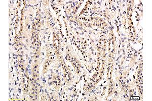 Formalin-fixed and paraffin embedded rat kidney labeled with Anti-phospho-AQP2(Ser269) Polyclonal Antibody, Unconjugated (ABIN756127) followed by conjugation to the secondary antibody and DAB staining (AQP2 抗体  (pSer269))