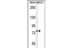 SORBS1 Antibody (Center) (ABIN654646 and ABIN2844342) western blot analysis in MDA-M cell line lysates (35 μg/lane). (SORBS1 抗体  (AA 866-892))