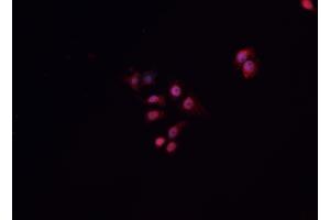 ABIN6268941 staining A549 cells by IF/ICC. (HNF1B 抗体  (Internal Region))