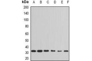 Western blot analysis of Cyclophilin E expression in Hela (A), THP1 (B), Jurkat (C), HL60 (D), mouse testis (E), mouse thymus (F) whole cell lysates. (PPIE 抗体)