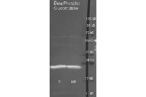 Goat anti antibody ( was used to detect purified Beta Phospho Glucomutase under reducing (R) and non-reducing (NR) conditions. (Beta-Phosphoglucomutase 抗体  (HRP))