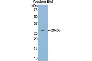 Western blot analysis of the recombinant protein. (SIGLEC5 抗体  (AA 147-335))