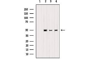 Western blot analysis of extracts from various samples, using K1H2 Antibody. (KRT32 抗体  (Internal Region))