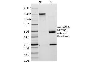 SDS-PAGE Analysis of Purified Cytokeratin 18 Mouse Monoclonal Antibody (KRT18/835). (KRT8, KRT18 抗体)