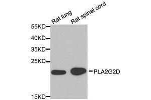 Western blot analysis of extracts of rat lung and rat spinal cord cell lines, using PLA2G2D antibody. (PLA2G2D 抗体)