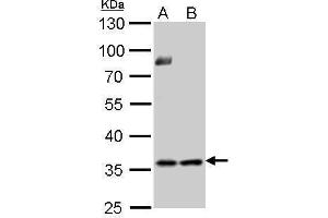 WB Image Thymidylate synthetase antibody detects TYMS protein by Western blot analysis. (TYMS 抗体)