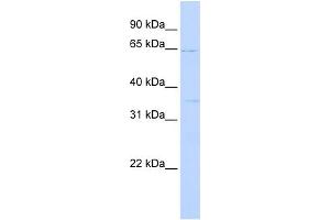 WB Suggested Anti-RORA Antibody Titration:  0. (RORA 抗体  (N-Term))