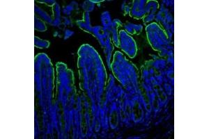 IF analysis of Villin using anti-Villin antibody (ABIN3042343).