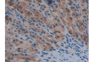 Detection of TXNRD1 in Rat Stomach Tissue using Polyclonal Antibody to Thioredoxin Reductase 1 (TXNRD1) (TXNRD1 抗体  (AA 208-433))