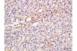 Formalin-fixed and paraffin embedded rat kidney labeled with Anti-CXCR7/RDC1 Polyclonal Antibody, Unconjugated (ABIN1387536) at 1:200 followed by conjugation to the secondary antibody and DAB staining. (CXCR7 抗体  (AA 151-250))