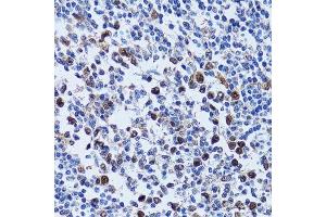 Immunohistochemistry of paraffin-embedded human tonsil using UHRF1 antibody. (UHRF1 抗体  (AA 1-260))