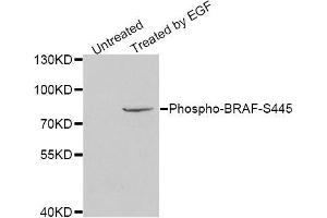Western Blotting (WB) image for anti-B-Raf proto-oncogene, serine/threonine kinase (BRAF) (pSer445) antibody (ABIN3019432) (BRAF 抗体  (pSer445))