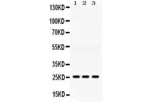 Western blot analysis of AK2 expression in rat liver extract ( Lane 1), mouse kidney extract ( Lane 2) and HELA whole cell lysates ( Lane 3). (Adenylate Kinase 2 抗体  (AA 161-239))