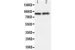 Western Blotting (WB) image for anti-Heat Shock Protein 90kDa beta (Grp94), Member 1 (HSP90B1) (AA 687-700), (Middle Region) antibody (ABIN3044299)
