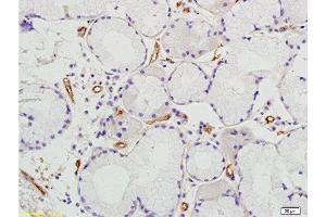Formalin-fixed and paraffin embedded human colon tissue labeled with Anti Prominin2 Polyclonal Antibody, Unconjugated  at 1:200 followed by conjugation to the secondary antibody and DAB staining (Prominin 2 抗体  (AA 301-400))