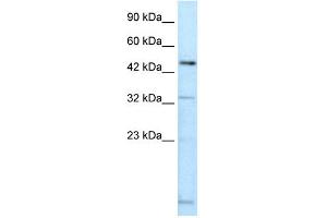WB Suggested Anti-DMRTA2 Antibody Titration: 0. (DMRTA2 抗体  (C-Term))