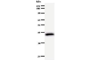 Western Blotting (WB) image for anti-FER Tyrosine Kinase (FER) antibody (ABIN933005) (FER 抗体)