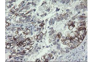 Image no. 13 for anti-Src-like-adaptor 2 (SLA2) antibody (ABIN1500949)