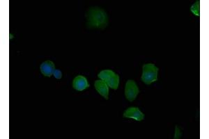 Immunofluorescence staining of MCF-7 cells with ABIN7139704 at 1:50, counter-stained with DAPI.