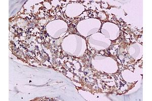 Immunohistochemistry (IHC) image for anti-Tumor Necrosis Factor (Ligand) Superfamily, Member 11 (TNFSF11) (AA 221-300) antibody (ABIN668556)