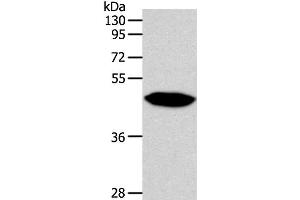 Western Blot analysis of Human fetal brain tissue using NPY1R Polyclonal Antibody at dilution of 1:500 (NPY1R 抗体)