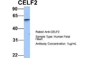 Host: Rabbit Target Name: CELF2 Sample Type: Human Fetal Heart Antibody Dilution: 1. (CELF2 抗体  (N-Term))