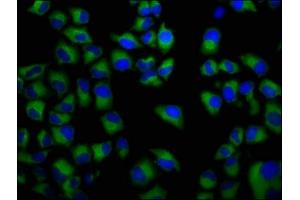 Immunofluorescence staining of Hela cells with ABIN7152666 at 1:133, counter-stained with DAPI. (FCRL5 抗体  (AA 419-553))