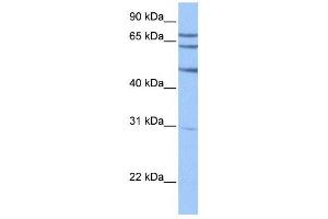 TSKS antibody used at 1 ug/ml to detect target protein. (TSKS 抗体  (N-Term))