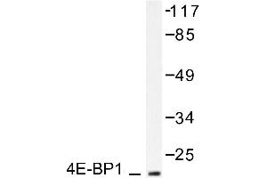 Image no. 2 for anti-Eukaryotic Translation Initiation Factor 4E Binding Protein 1 (EIF4EBP1) antibody (ABIN271863) (eIF4EBP1 抗体)