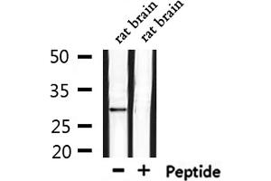 Western blot analysis of extracts from rat brain, using OR6C75 Antibody. (OR6C75 抗体)