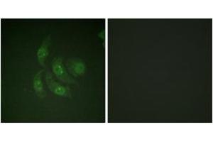 Immunofluorescence analysis of HepG2 cells, using CaMK4 (Ab-196/200) Antibody. (CAMK4 抗体  (AA 166-215))