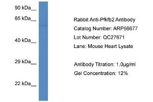 Western Blotting (WB) image for anti-6-phosphofructo-2-Kinase/fructose-2,6-Biphosphatase 2 (PFKFB2) (C-Term) antibody (ABIN2786833) (PFKFB2 抗体  (C-Term))