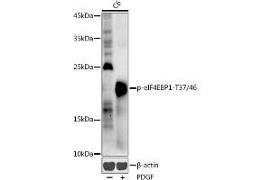 Western blot analysis of extracts of C6 cells, using Phospho-eIF4EBP1-T37/46 antibody (ABIN3019469, ABIN3019470, ABIN3019471 and ABIN6225387) at 1:1000 dilution. (eIF4EBP1 抗体  (pThr37, pThr46))